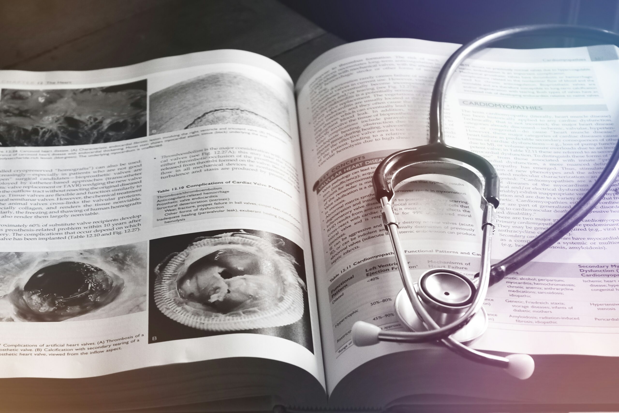 Primary Sclerosing Cholangitis